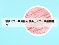 额头长了一块藓图片 额头上长了一块癣的图片