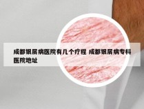 成都银屑病医院有几个疗程 成都银屑病专科医院地址