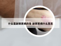 什么是副银屑病改变 副银屑病什么意思