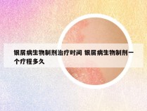 银屑病生物制剂治疗时间 银屑病生物制剂一个疗程多久