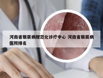 河南省银屑病规范化诊疗中心 河南省银屑病医院排名