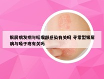 银屑病发病与咽喉部感染有关吗 寻常型银屑病与嗓子疼有关吗