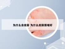 为什么会皮藓 为什么皮藓很难好
