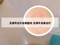无锡专治牛皮癣医院 无锡牛皮廨治疗