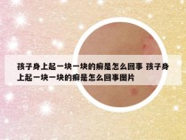 孩子身上起一块一块的癣是怎么回事 孩子身上起一块一块的癣是怎么回事图片