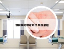 银屑病的理论知识 银屑病题