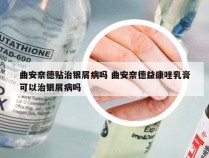 曲安奈德贴治银屑病吗 曲安奈德益康唑乳膏可以治银屑病吗