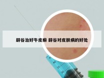 辟谷治好牛皮癣 辟谷对皮肤病的好处