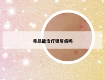 毒品能治疗银屑病吗