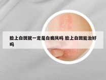 脸上白斑就一定是白癜风吗 脸上白斑能治好吗