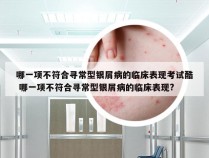 哪一项不符合寻常型银屑病的临床表现考试酷 哪一项不符合寻常型银屑病的临床表现?
