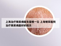 上海治疗银屑病医生是哪一位 上海哪家医院治疗银屑病最好的地方