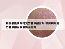 银屑病能长期吃复方甘草酸苷吗 银屑病用复方甘草酸苷胶囊能治愈吗