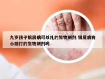 九岁孩子银屑病可以扎的生物制剂 银屑病有小孩打的生物制剂吗