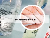 牛皮癣最怕吃什么水果