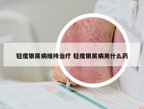 轻度银屑病维持治疗 轻度银屑病用什么药