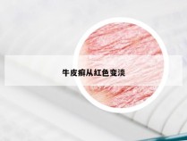 牛皮癣从红色变淡