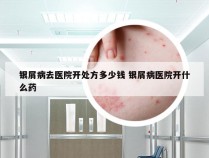 银屑病去医院开处方多少钱 银屑病医院开什么药