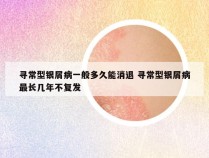 寻常型银屑病一般多久能消退 寻常型银屑病最长几年不复发
