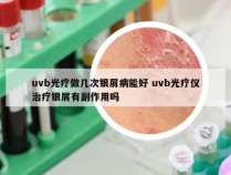 uvb光疗做几次银屑病能好 uvb光疗仪治疗银屑有副作用吗