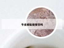牛皮癣能做餐饮吗