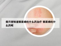 我只想知道银屑病吃什么药治疗 银屑病吃什么药呢