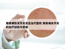 银屑病性关节炎首选治疗医院 银屑病关节炎的治疗经验与感悟