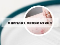 银屑病抹药多久 银屑病抹药多久可以洗