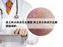 身上长小白点什么原因 身上长小白点什么原因造成的
