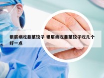 银屑病吃韭菜饺子 银屑病吃韭菜饺子吃几个好一点