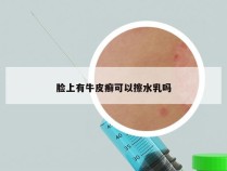 脸上有牛皮癣可以擦水乳吗