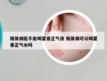 银屑病能不能喝藿香正气液 银屑病可以喝藿香正气水吗
