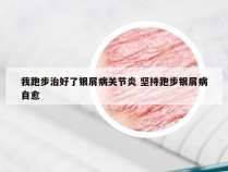 我跑步治好了银屑病关节炎 坚持跑步银屑病自愈