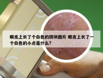 眼皮上长了个白色的斑块图片 眼皮上长了一个白色的小点是什么?
