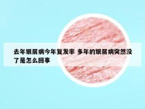 去年银屑病今年复发率 多年的银屑病突然没了是怎么回事