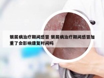 银屑病治疗期间感冒 银屑病治疗期间感冒加重了会影响康复时间吗
