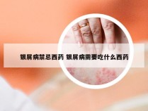 银屑病禁忌西药 银屑病需要吃什么西药
