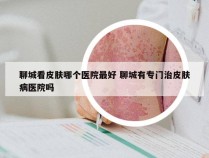 聊城看皮肤哪个医院最好 聊城有专门治皮肤病医院吗