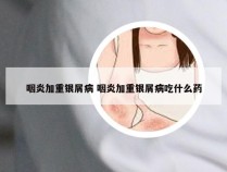 咽炎加重银屑病 咽炎加重银屑病吃什么药