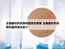 全国最好的皮肤科医院在哪里 全国最好的皮肤科医院排名前十
