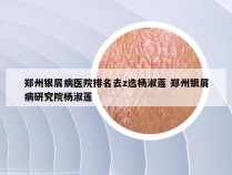 郑州银屑病医院排名去z选杨淑莲 郑州银屑病研究院杨淑莲