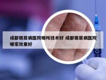 成都银屑病医院哪所技术好 成都银屑病医院哪家效果好