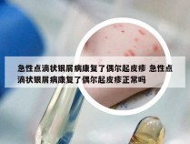 急性点滴状银屑病康复了偶尔起皮疹 急性点滴状银屑病康复了偶尔起皮疹正常吗