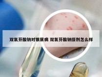 双氯芬酸钠对银屑病 双氯芬酸钠搽剂怎么样