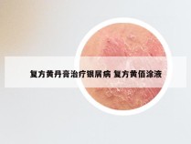 复方黄丹膏治疗银屑病 复方黄佰涂液