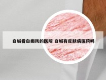 白城看白癜风的医院 白城有皮肤病医院吗