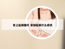 背上起癣图片 背部起癣什么症状