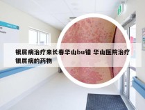 银屑病治疗来长春华山bu错 华山医院治疗银屑病的药物