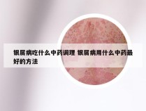 银屑病吃什么中药调理 银屑病用什么中药最好的方法