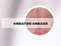 水杨酸治疗体癣 水杨酸治皮癣